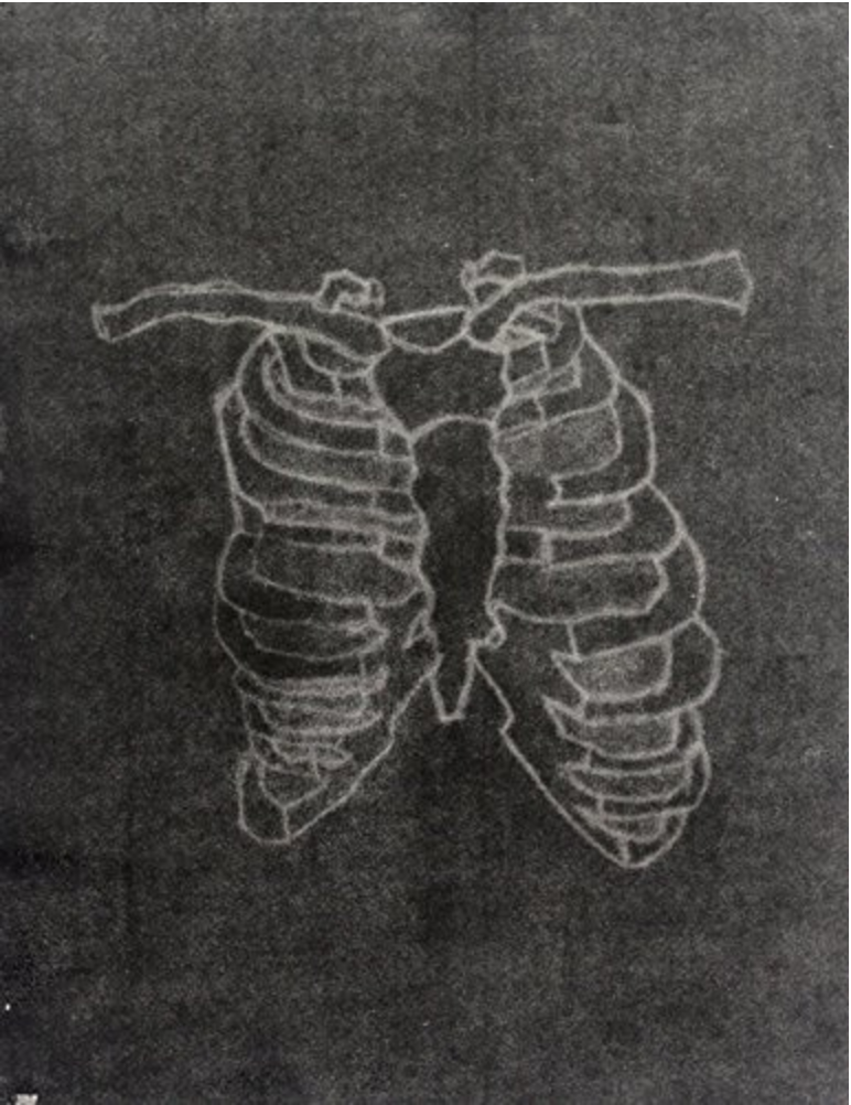 Bones - Invert by Victor Prieto