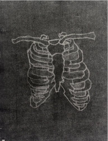 Bones - Invert by Victor Prieto